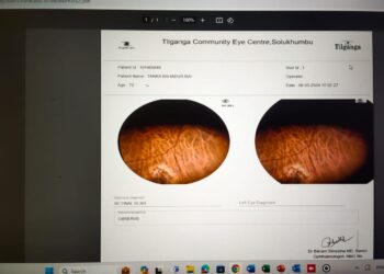 आँखाको परीक्षणका लागी सोलुमा  “टेलिअप्थाल्मोलोजि” सेवा