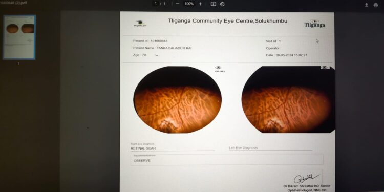 आँखाको परीक्षणका लागी सोलुमा  “टेलिअप्थाल्मोलोजि” सेवा