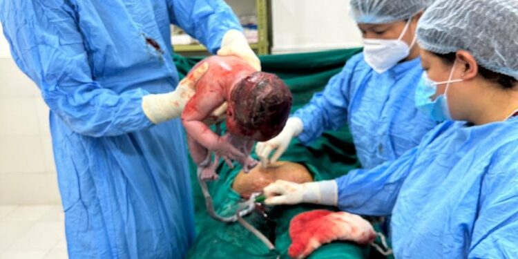 थुलुङ दुधकोशी अस्पतालमा अर्को शल्य प्रसुती, २२ वर्षीय तामाङले दिइन छोरीलाई जन्म 