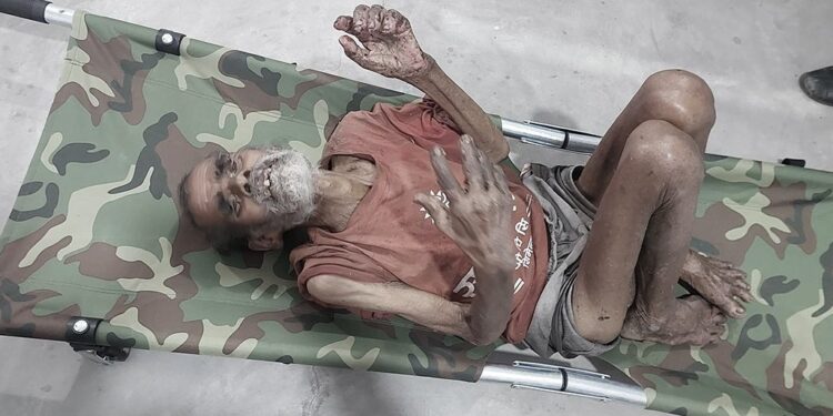 छोराबुहारीले जंगलमा छोडेर गए बाबु, ४ दिन भोकै जंगलमै सुते जामुनलाल