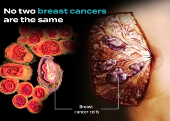 स्तनपान नगराउने महिलालाई स्तन र डिम्बासयको क्यान्सरको जोखिम बढ्दो