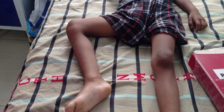 ‘प्यारालाइसिस’ले थलिएकी एञ्जिलाको उपचारमा सहयोगको अपिल