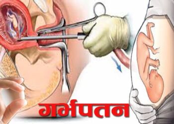 ओखलढुङ्गामा दुई महिनाको शिशु गर्भपतन गरि सडकमा फाल्ने दुई जना पक्राउ