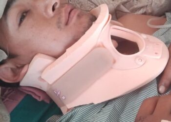 हिमाल दर्शन माविका लेखापाल मगरको सफल शल्यक्रिया