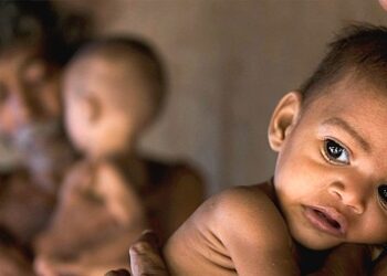 सोलुका ४ जना सहित ओखलढुगांका १३ जना बालबालिका कुपोषण