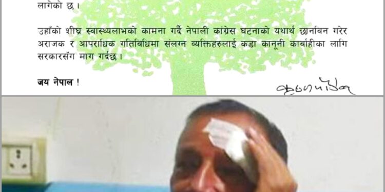 कोशीका पूर्वमुख्यमन्त्रीमाथि भएको आक्रमणको कांग्रेसद्वारा निन्दा