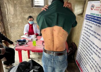 सोलुका कैदीबन्दीमा देखियो ठेउला संक्रमण, २८ जनाको उपचार