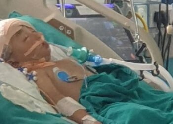 बाबुको खुकुरी प्रहारबाट गम्भीर घाईते भएकी बालिकाको अप्रेशन सफल