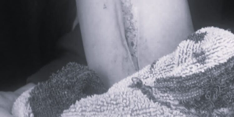 सोलुखुम्बुमा सौतेनी बाबुको खुकुरी प्रहारबाट २२ वर्षीय युवक घाइते