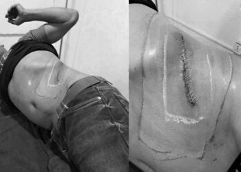 सिन्धुलीका भुजेललाई भारत लगेर मिर्गौला तस्करी गर्ने एक जना पक्राउ