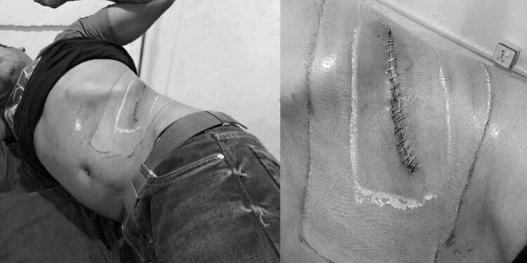 सिन्धुलीका भुजेललाई भारत लगेर मिर्गौला तस्करी गर्ने एक जना पक्राउ