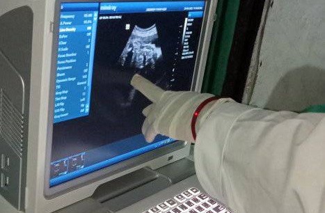 टाक्सिन्दुमा निःशुल्क ग्रामीण भिडियो एक्स–रे सेवा सञ्चालन गरिने