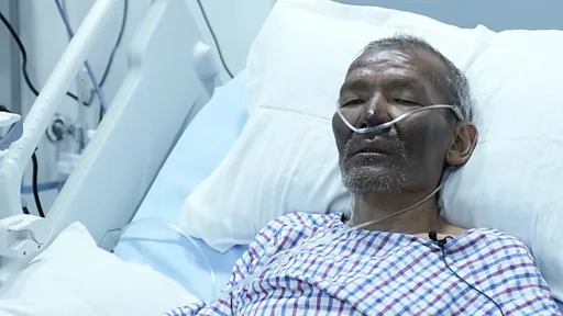सगरमाथा दुर्घटनामा घाइते शेर्पाका लागि ८१ लाख रुपैयाँभन्दा बढी सहयोग संकलन