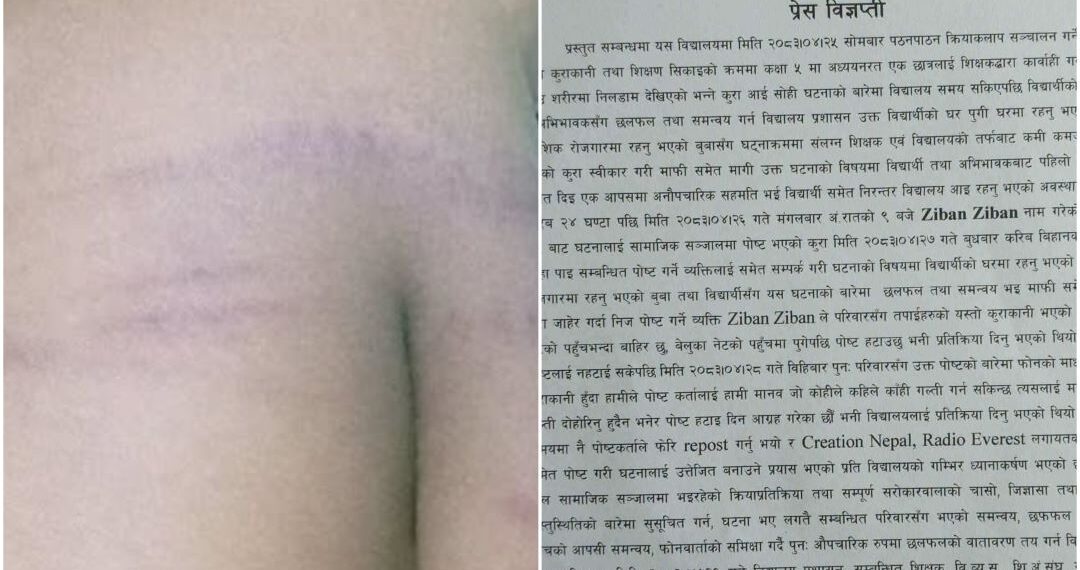 विद्यार्थी कुट्ने शिक्षकद्वारा गल्ती स्वीकार, अभिभावकसँग मागे माफी