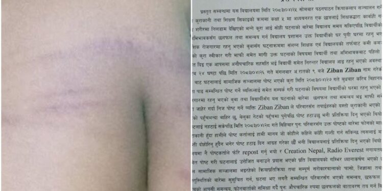 विद्यार्थी कुट्ने शिक्षकद्वारा गल्ती स्वीकार, अभिभावकसँग मागे माफी